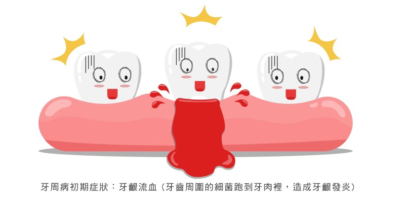 水雷射牙周治療
